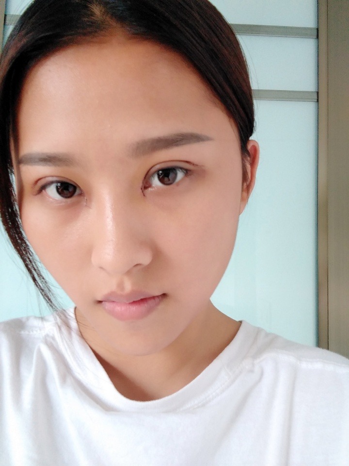 韩美做双眼皮,南昌韩美医院做双眼皮怎么样