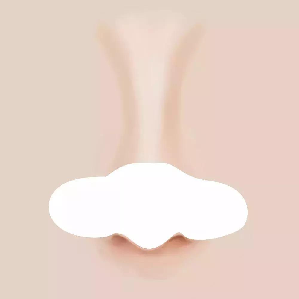 有黑头又泛红的草莓鼻怎么办,如何用医美去除草莓鼻和黑头