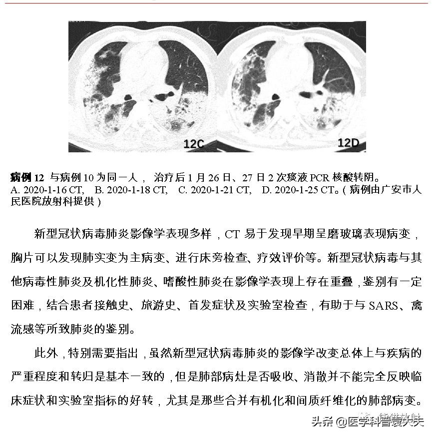 最新新型冠状病毒肺炎的指南,最新新型冠状病毒肺炎防控指南