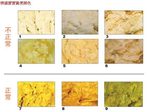 宝宝便便颜色分析,宝宝正常便便的颜色和形状