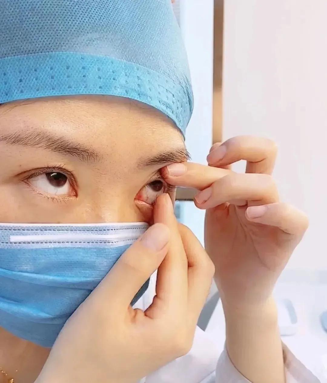 摘隐形眼镜有什么好方法吗,隐形眼镜怎样摘