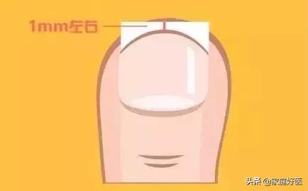 甲沟炎穿什么鞋袜最合适 (甲沟炎恢复了穿凉鞋还会复发吗)