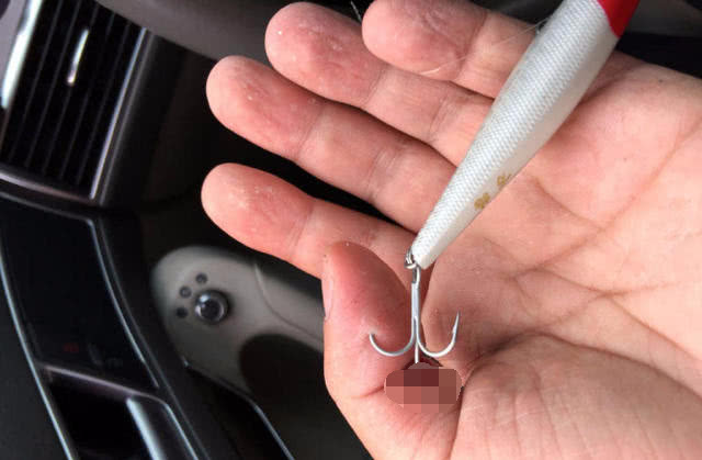 钓鱼时被刺到,为什么每次钓鱼都会被鱼钩伤到