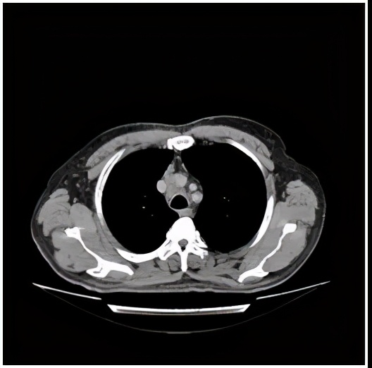 奇迹再现治愈版,医学奇迹再现视频