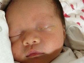 刚满月宝宝眼睛有眼屎还流泪,刚满月的小孩一只眼老长眼屎