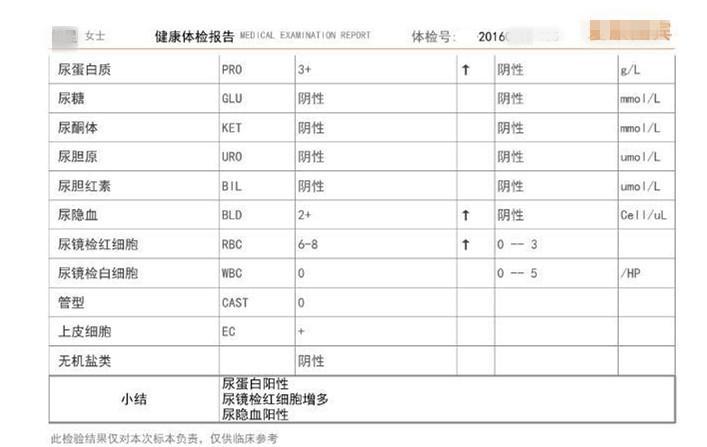 肾炎肌酐200能治愈吗,慢性肾炎肌酐多少需要透析