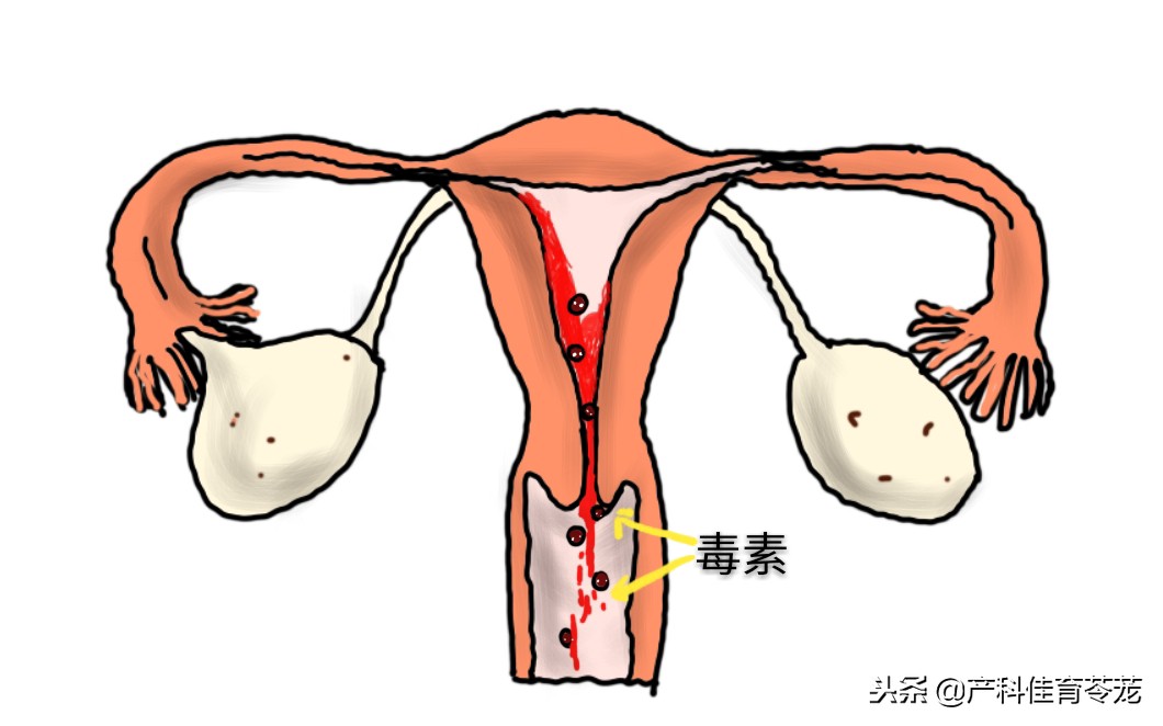 月经量少带血块怎么治,治月经量少的中药配方