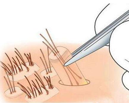 自然卷平时怎么打理,自然卷打理技巧和方法