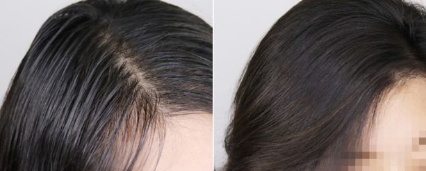 什么头发喷雾让头发干得蓬松,不用洗头也能让头发蓬松的喷雾