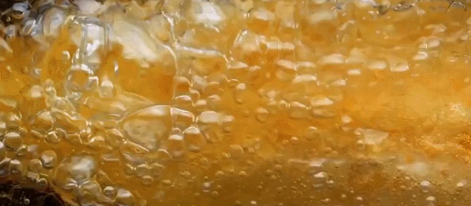 一男子体内取出224多颗胆结石,胆结石取出500个