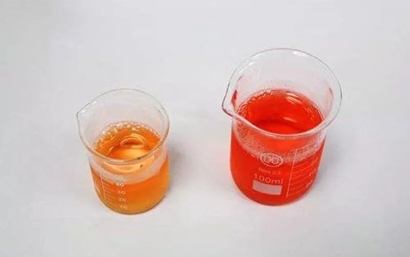 出现血尿就真的患了肾脏疾病吗?