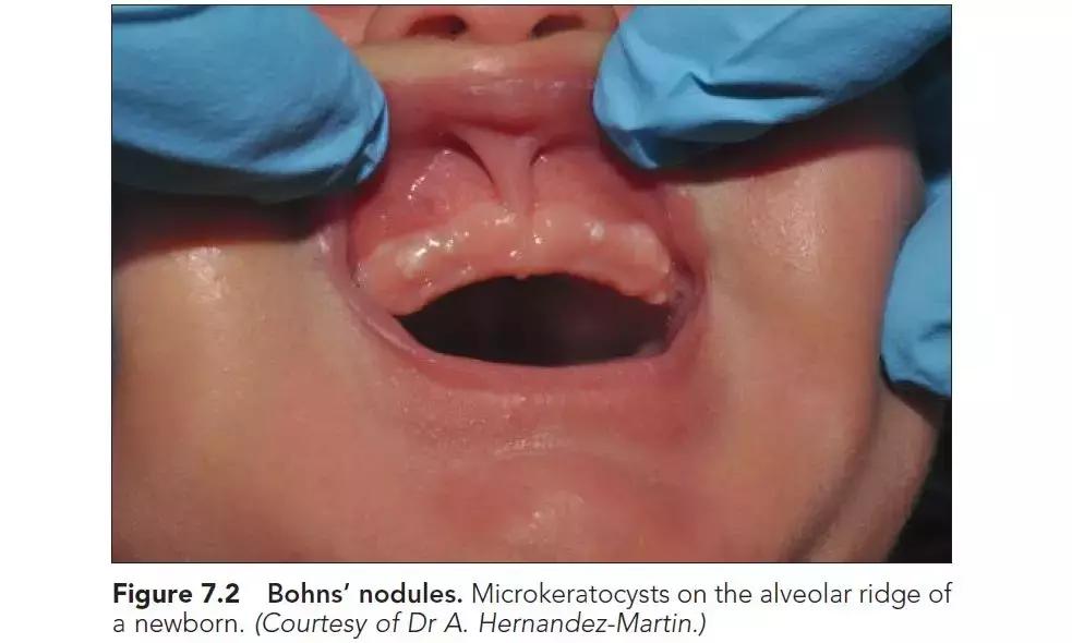 新生儿皮肤问题大全一览表,新生儿常见八大皮肤问题