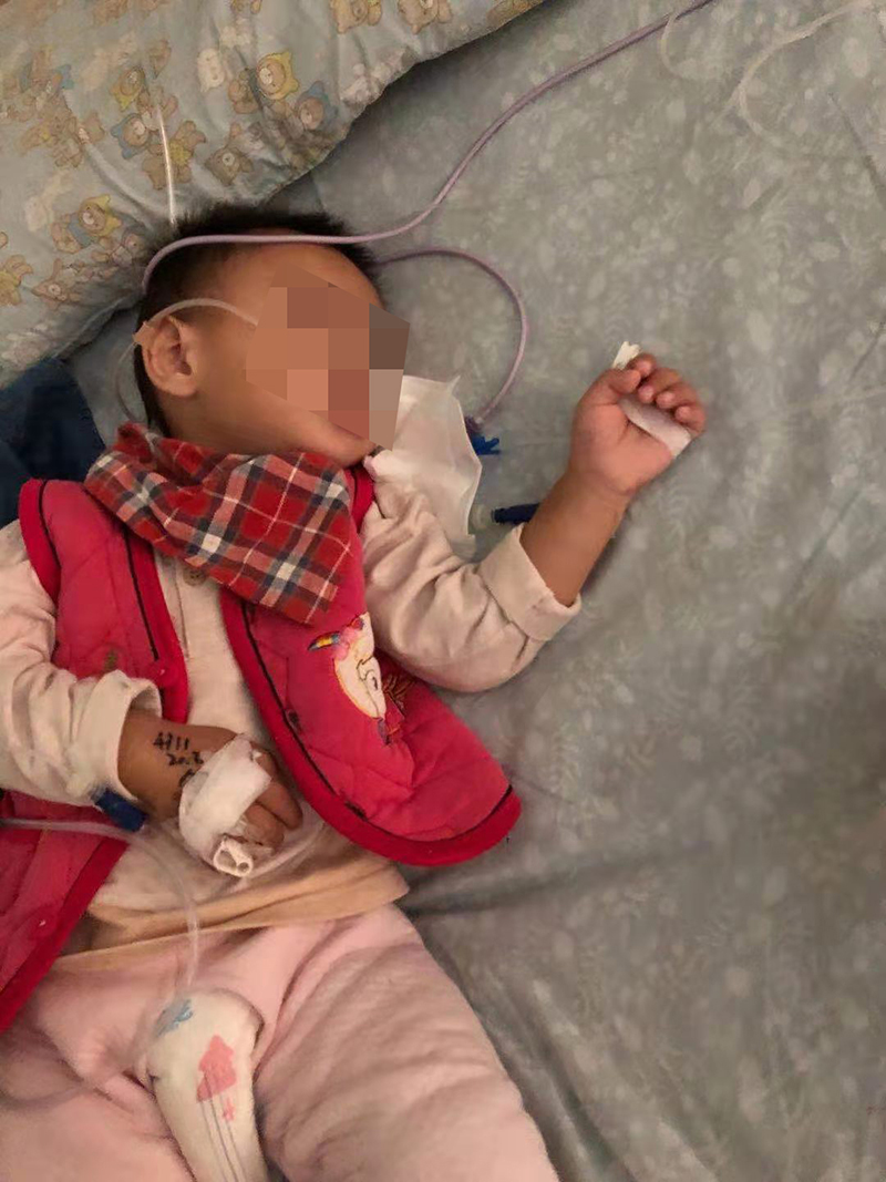 1岁男童误吞电池,一岁男童误吞电池