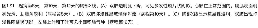 全球第一例新冠肺炎确诊病例,世界首例新冠肺炎解剖第一人