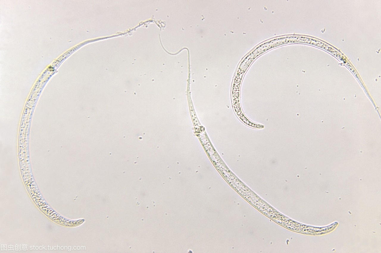 吃阿苯达唑片后应该注意什么,使用阿达帕林需要注意什么