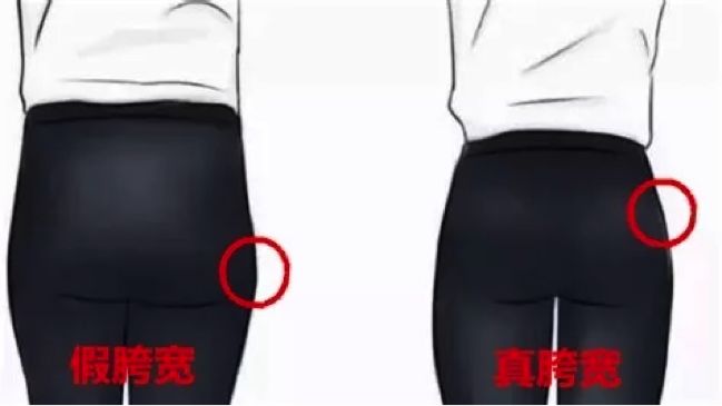 上身很瘦下身胯部宽,上身很瘦而下身正常