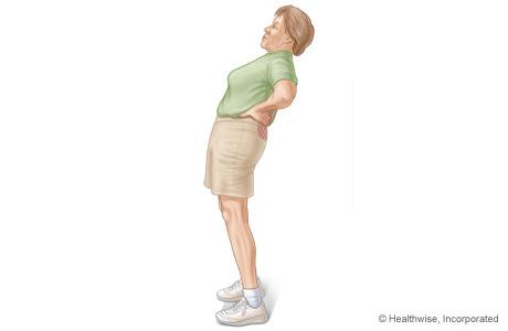 腰椎管狭窄症是怎么回事儿（二）该保守还是要手术呢？