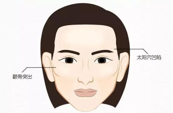 颧骨大克夫是真的吗,颧骨大克夫么