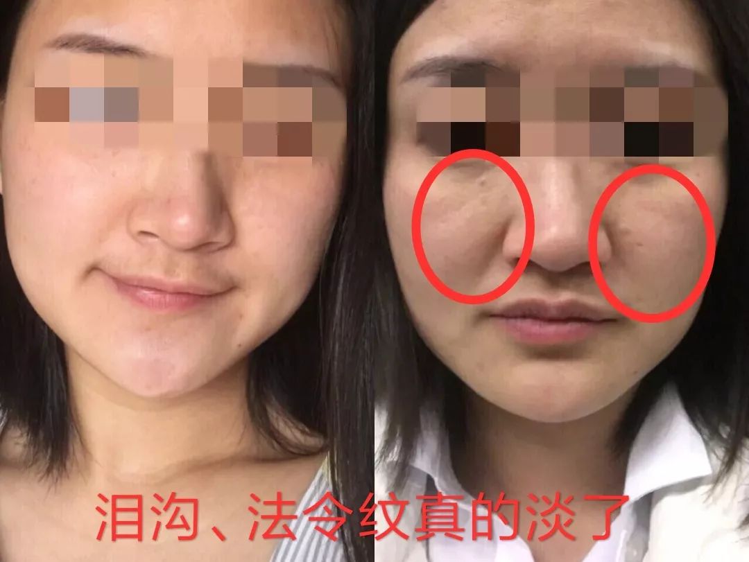 一年四季都能用的保湿面霜,皮肤干推荐一款好用的面霜