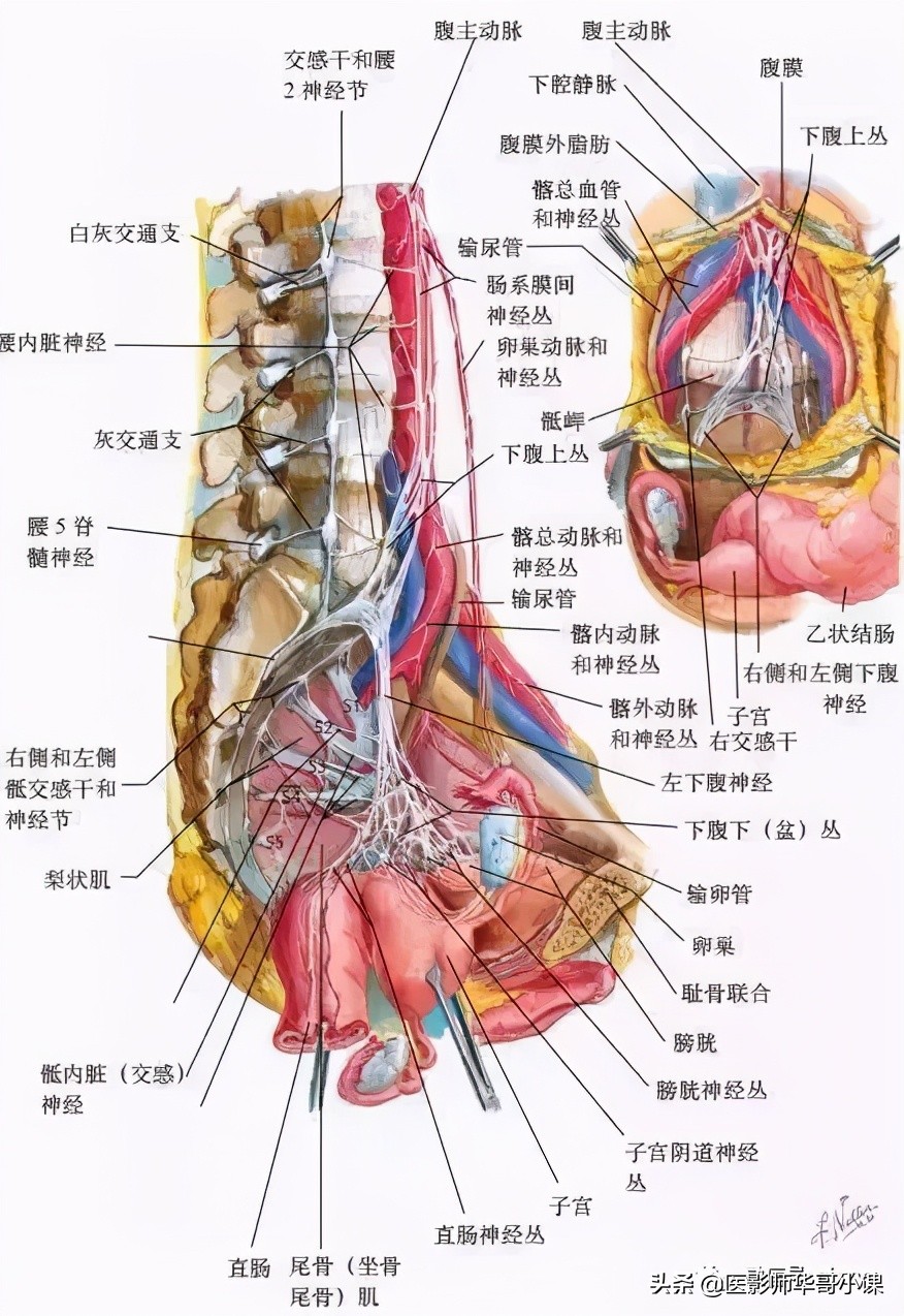 盆腔积液ct解剖图谱,盆腔解剖图谱手绘步骤