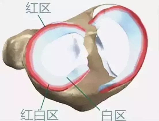 半月板损伤的症状及治疗方法图片,什么样的动作会让半月板损伤加重
