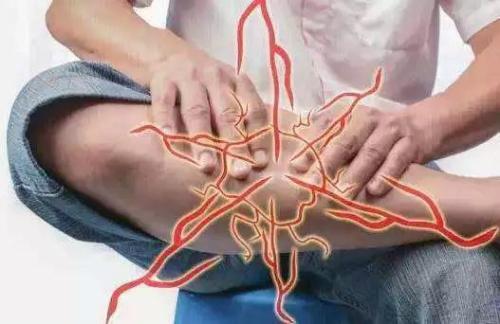 腿抽筋缺钙真的是这样吗,腿抽筋是真的缺钙引起的吗