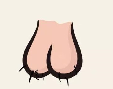 先天性隐睾没找到睾丸,蛋蛋疝气怎么治疗最好