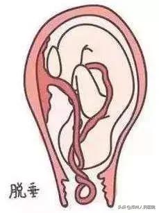 想体验“在家生娃”?生过的人都表示:还想再生一个