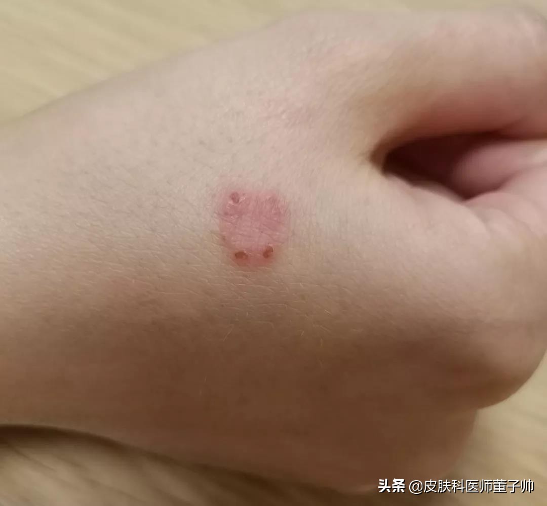 宠物易出现的皮肤病,养宠物容易感染哪些疾病