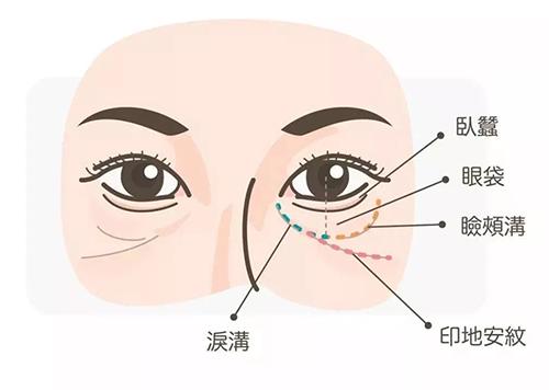 「印第安纹」*伤杀**力多大？让少女秒变大妈