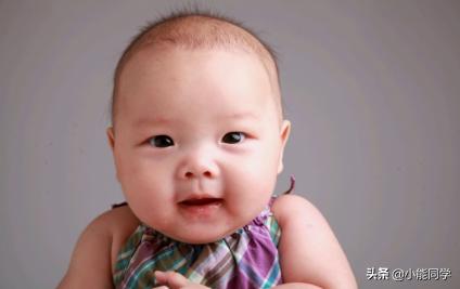 孩子头发稀是缺啥,孩子头发稀黄就是营养不良吗