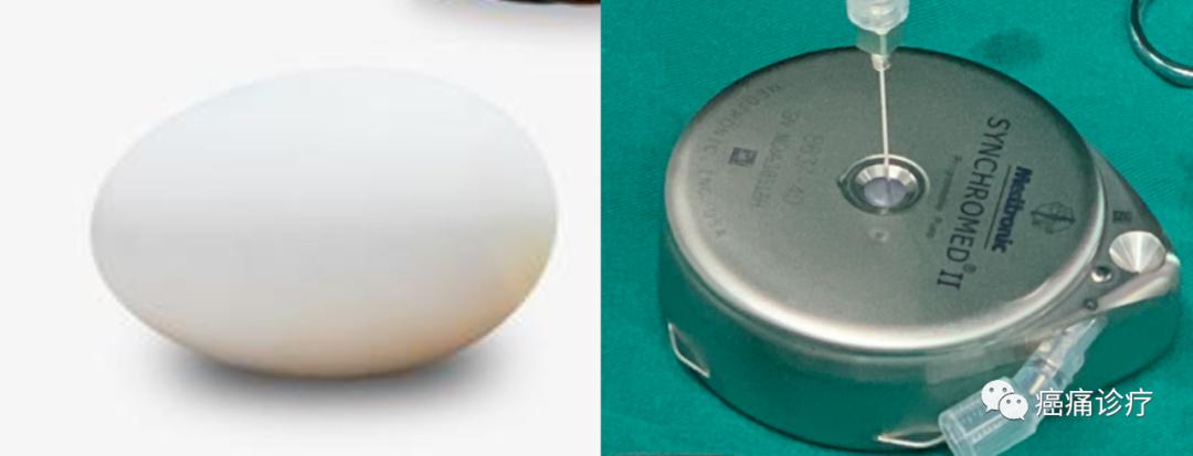 癌痛吃止痛药副作用大怎么办,吃癌痛药的副作用