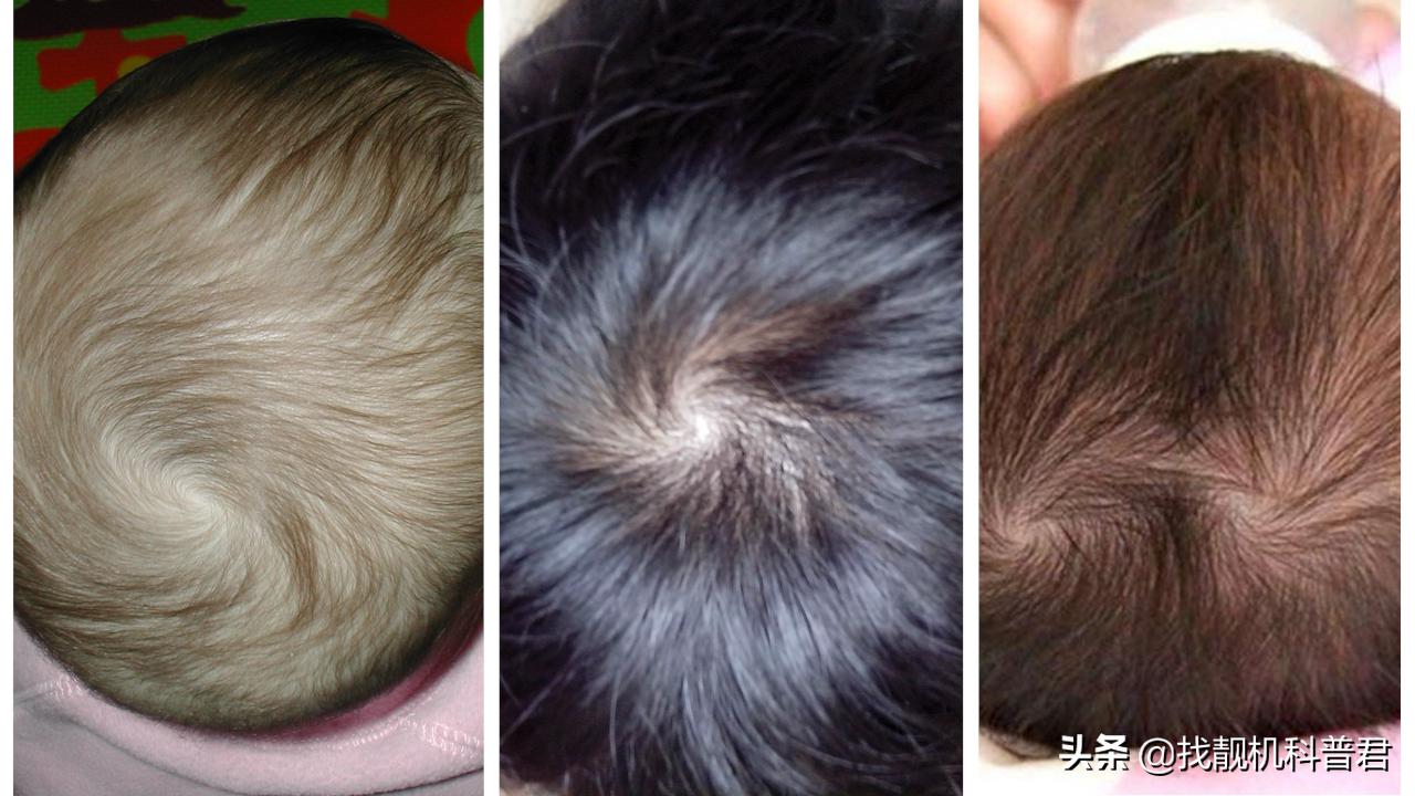 有两个发旋的人智商,发旋会遗传吗