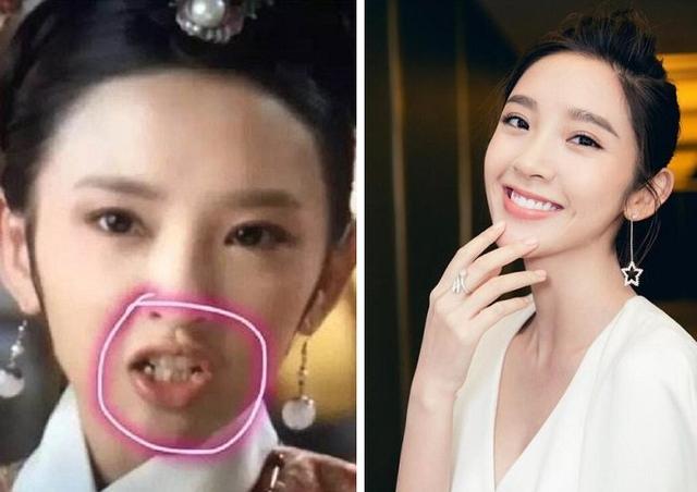 哪些明星整牙后像整容,明星整牙变美了