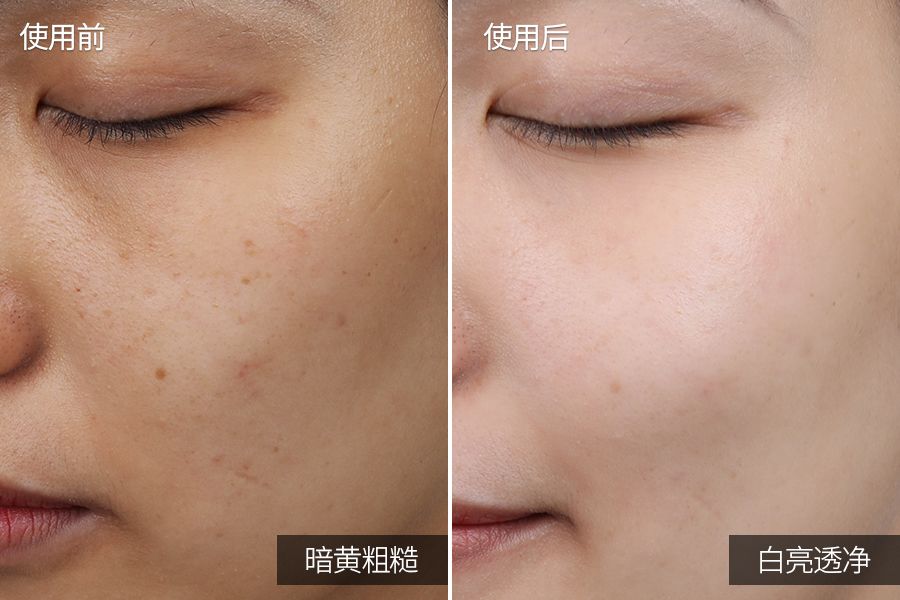 琚佸濮楁帹鑽愯憽钀勭苯鎶よ偆,琚佸濮楄憽钀勭苯绮惧崕