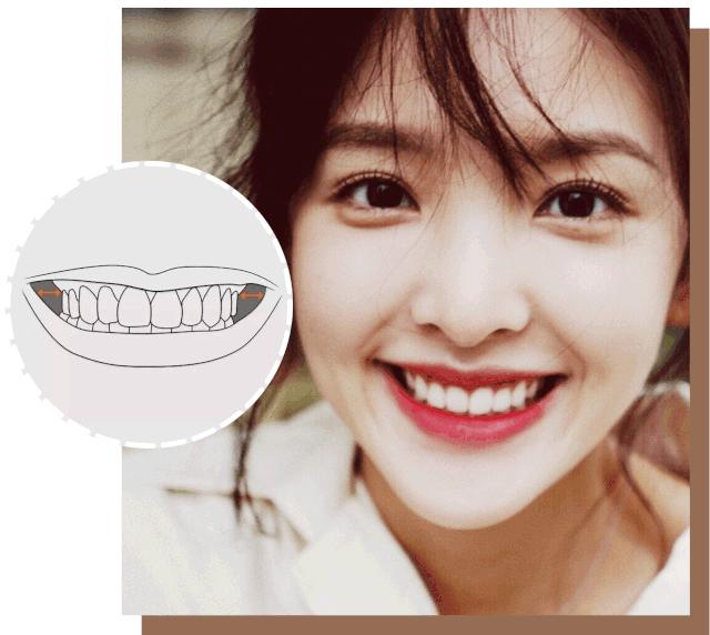 怎么练出angelababy微笑唇,angelababy演技微笑唇