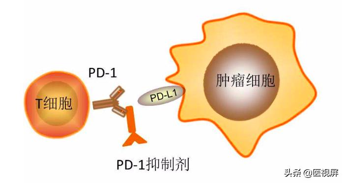 恶性肿瘤化疗科普,化疗医生建议用最新的特效药