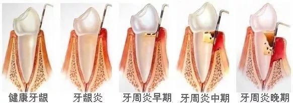 老年人口腔健康知识总结,中老年人口腔保健知识科普