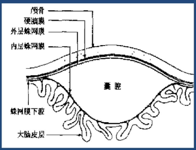 病例咨询:22个月大的小女孩,患了蛛网膜囊肿,该不该手术?