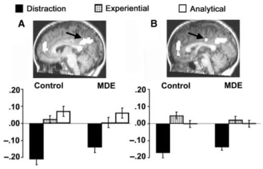 抑郁双向什么意思,抑郁状态三大症状