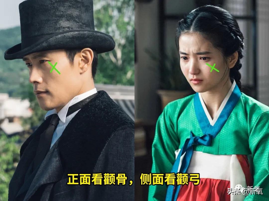 阔面脸轮廓怎么做,阔面脸怎么做医美