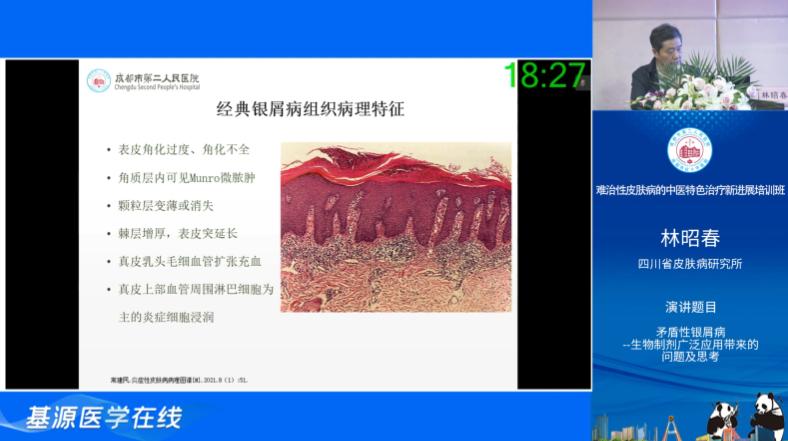 成都中医治疗皮肤疑难杂症,皮肤病中医成都