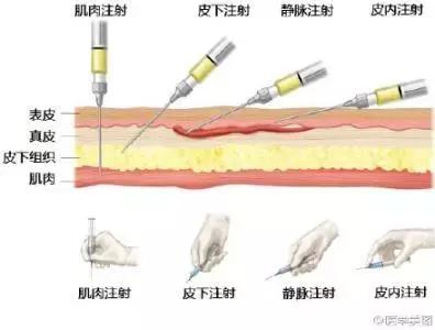 低分子肝素一次注射多少,低分子肝素注射的注意事项