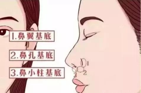 协和整形美容科专家,北京协和整形鼻综合