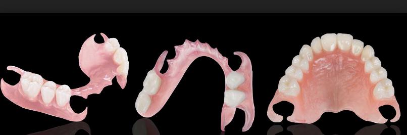 假牙制造技术,制作假牙技术有哪些