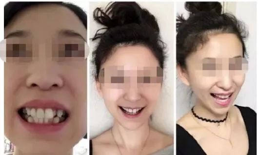 90后整牙破产,90后因为吃喝玩乐负债3万