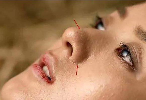 小苏打去黑头刺痛怎么回事,小苏打去黑头简单便宜效果又好