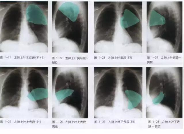 休闲小白鞋夏,献血小板相当于献血多少