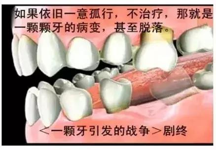 牙齿正面有小黑点千万不要忽视,不要小看牙齿的小黑点