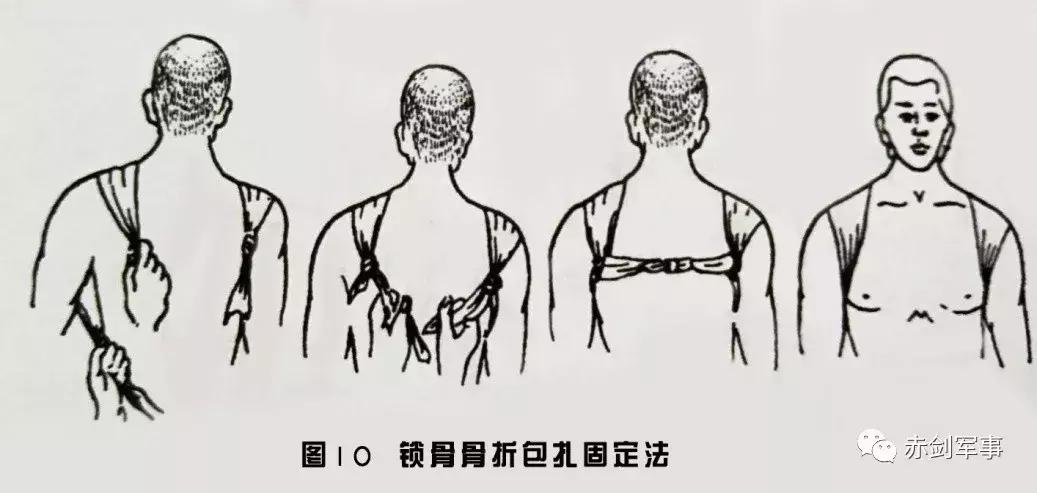 军队三角巾包扎法视频,部队卫生与救护三角巾包扎方法